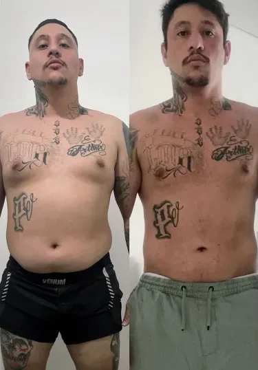 antes e depois